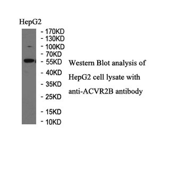 ACVR2B Rabbit Polyclonal Antibody