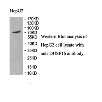 DUSP16 Rabbit Polyclonal Antibody