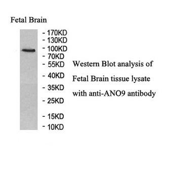 ANO9 Rabbit Polyclonal Antibody