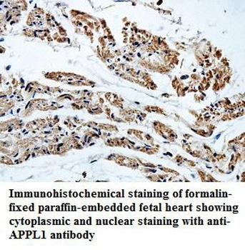 APPL1 Rabbit Polyclonal Antibody