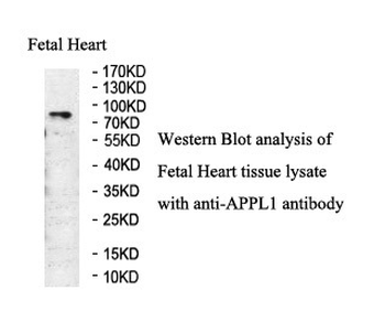 APPL1 Rabbit Polyclonal Antibody