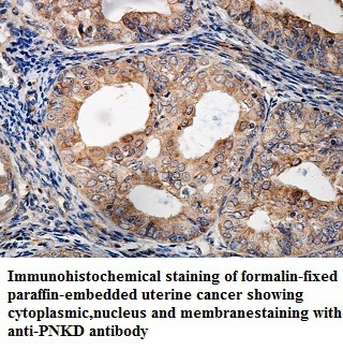 PNKD Rabbit Polyclonal Antibody