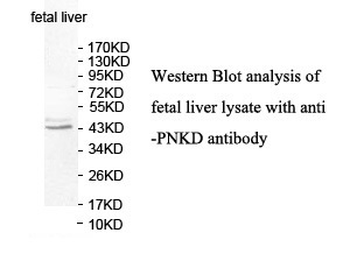 PNKD Rabbit Polyclonal Antibody