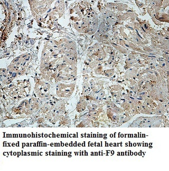 F9 Rabbit Polyclonal Antibody