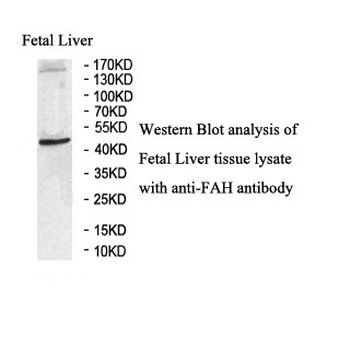 FAH Rabbit Polyclonal Antibody
