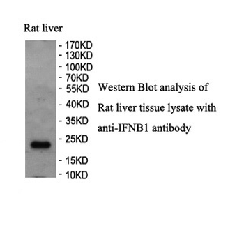 IFNB1 Rabbit Polyclonal Antibody