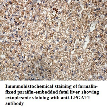 LPGAT1 Rabbit Polyclonal Antibody
