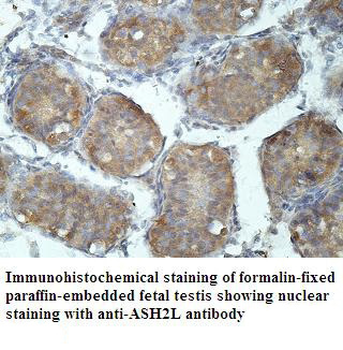 ASH2L Rabbit Polyclonal Antibody