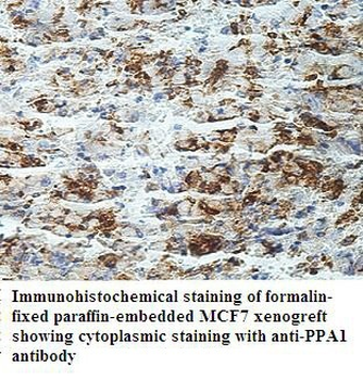 PPA1 Rabbit Polyclonal Antibody