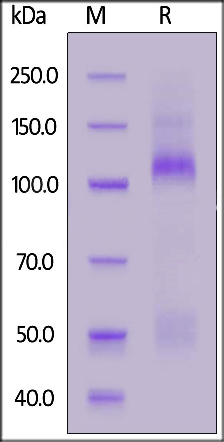 Mouse IGF-I R Protein, His Tag