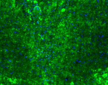 Goat anti-VAChT Antibody