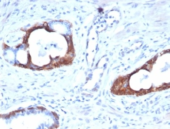 KRT14 Antibody