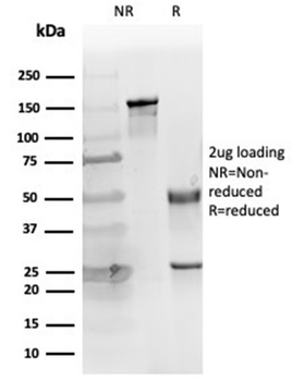 KRT14 Antibody