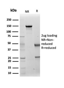 KRT14 Antibody
