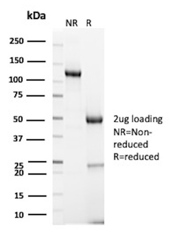 Recombinant GLG1 (Golgi Glycoprotein 1) (Marker for Human Cells) Antibody