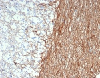 GFAP (Astrocyte & Neural Stem Cell Marker) Antibody