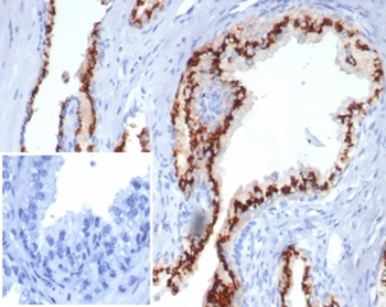 SLC45A3 Antibody