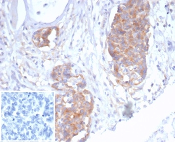 TP63 Antibody