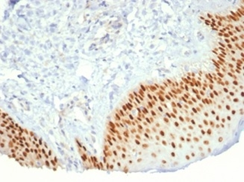 TP63 Antibody