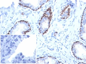 TP63 Antibody