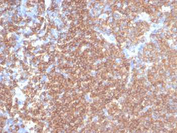 PTPRC Antibody