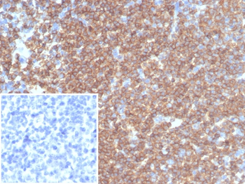 PTPRC Antibody