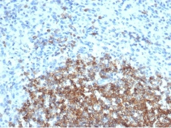 CR1 Antibody