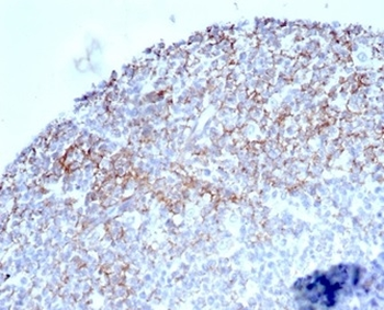 CR1 Antibody