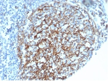 CR1 Antibody