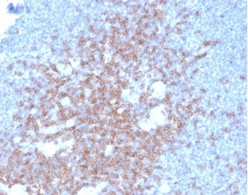 CD2 Antibody