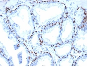 TP63 Antibody