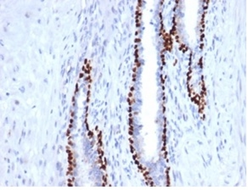 TP63 Antibody