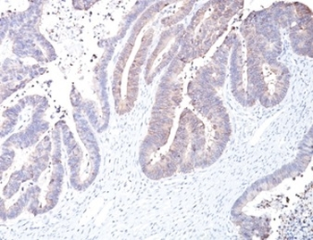 PTGS2 Antibody