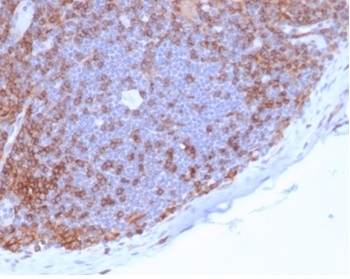 CD4 Antibody