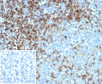 CD4 Antibody