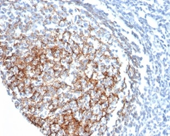 CR1 Antibody