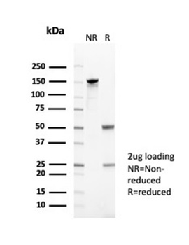 CR1 Antibody