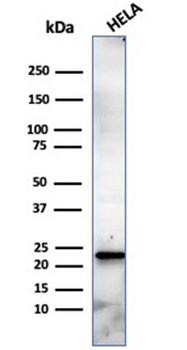 CBFB Antibody