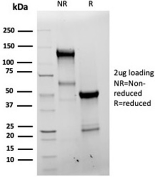 Recombinant Bcl-X (Apoptosis Marker) Antibody