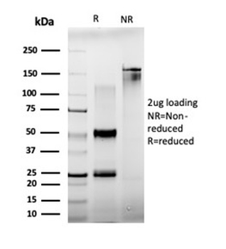 BCL11A / CTIP1 (Transcription Factor) Antibody