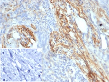 PIK3R2 Antibody