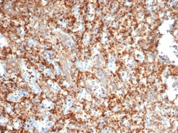 PIK3R2 Antibody