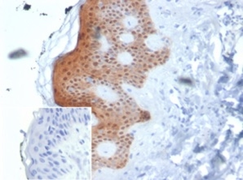 SERPINB5 Antibody