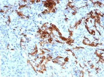 NGFR Antibody