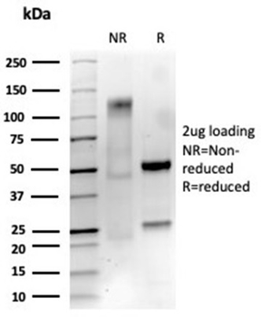 NGFR Antibody