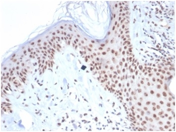NPM1 Antibody