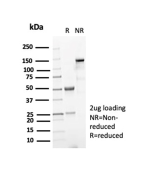 NPM1 Antibody