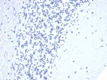 CD5 Antibody