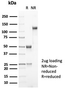 MDM2 Antibody