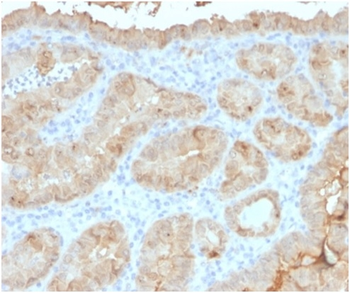 LGALS3 Antibody